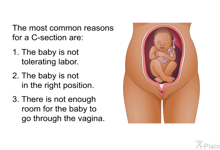 The most common reasons for a C-section are:  The baby is not tolerating labor. The baby is not in the right position. There is not enough room for the baby to go through the vagina.