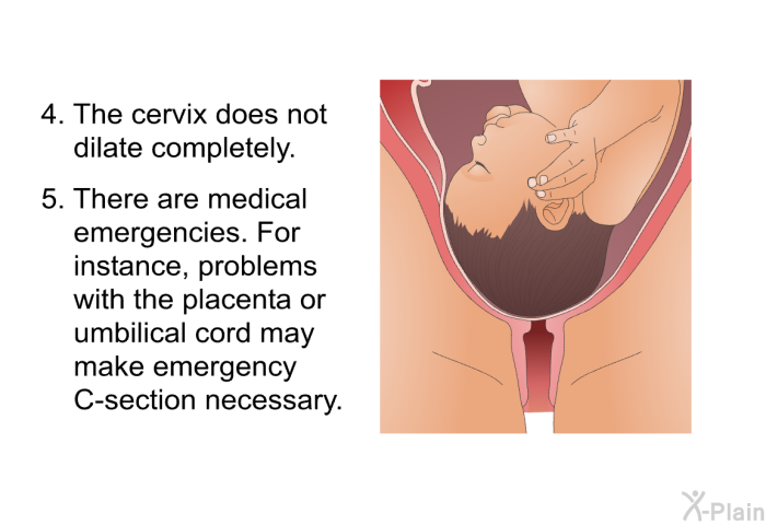 The cervix does not dilate completely. There are medical emergencies. For instance, problems with the placenta or umbilical cord may make emergency C-section necessary.