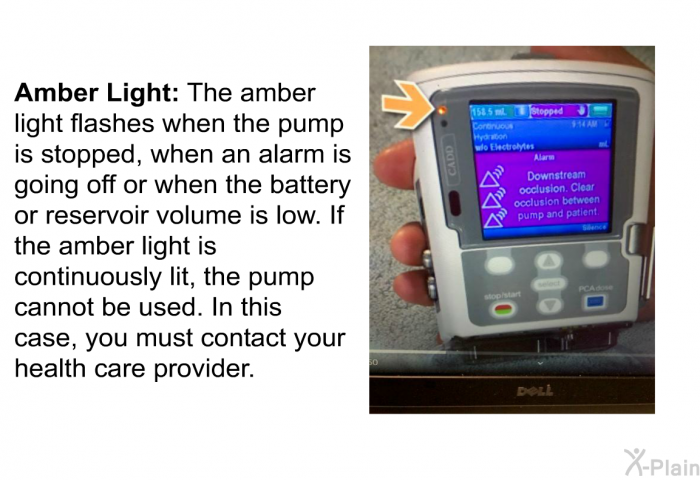<B>Amber Light:</B> The amber light flashes when the pump is stopped, when an alarm is going off or when the battery or reservoir volume is low. If the amber light is continuously lit, the pump cannot be used. In this case, you must contact your health care provider.