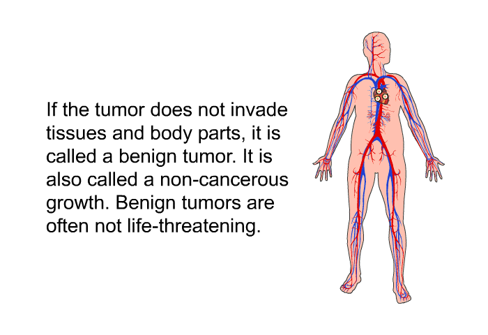 If the tumor does not invade tissues and body parts, it is called a benign tumor. It is also called a non-cancerous growth. Benign tumors are often not life-threatening.