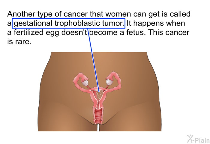 Another type of cancer that women can get is called a gestational trophoblastic tumor. It happens when a fertilized egg doesn't become a fetus. This cancer is rare.