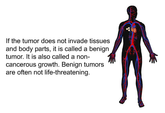 If the tumor does not invade tissues and body parts, it is called a benign tumor. It is also called a non-cancerous growth. Benign tumors are often not life-threatening.