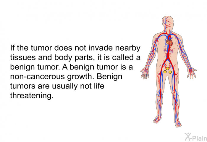 If the tumor does not invade nearby tissues and body parts, it is called a benign tumor. A benign tumor is a non-cancerous growth. Benign tumors are usually not life threatening.