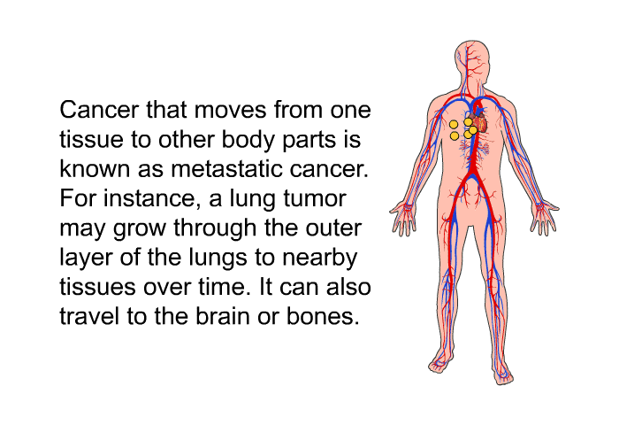Cancer that moves from one tissue to other body parts is known as metastatic cancer. For instance, a lung tumor may grow through the outer layer of the lungs to nearby tissues over time. It can also travel to the brain or bones.