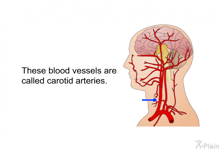 These blood vessels are called carotid arteries.