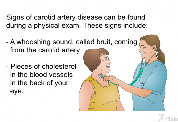 Signs of carotid artery disease can be found during a physical exam. These signs include:  A whooshing sound, called bruit, coming from the carotid artery. Pieces of cholesterol in the blood vessels in the back of your eye.