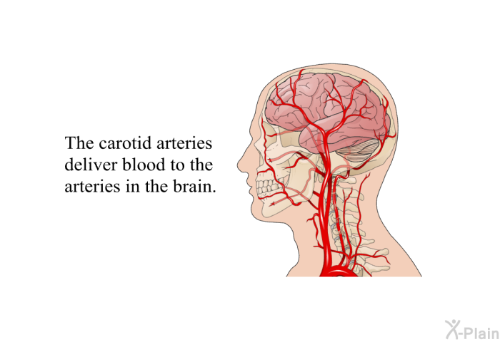 The carotid arteries deliver blood to the arteries in the brain.