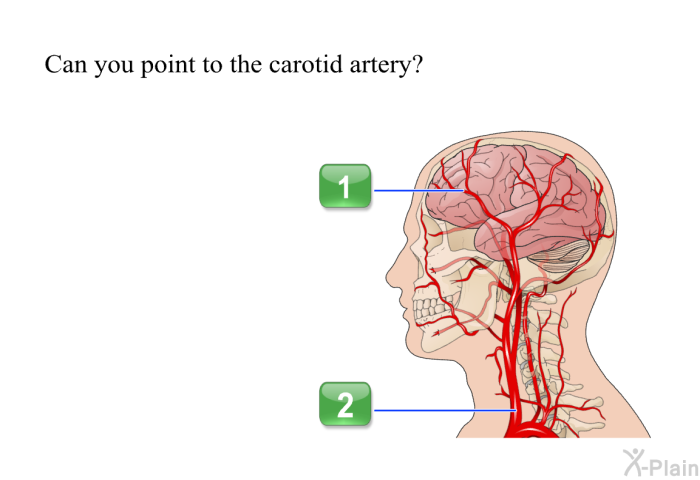 Can you point to the carotid artery?