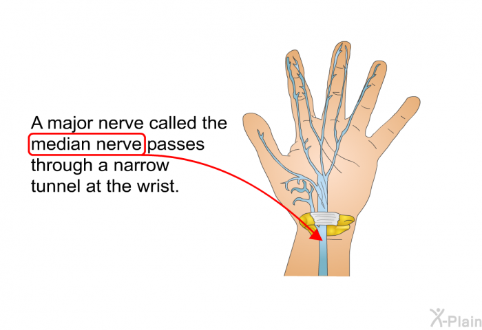A major nerve called the median nerve passes through a narrow tunnel at the wrist.