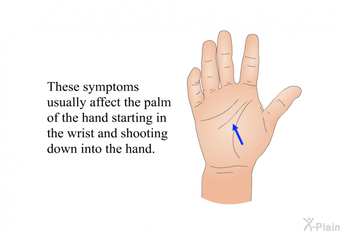 These symptoms usually affect the palm of the hand starting in the wrist and shooting down into the hand.