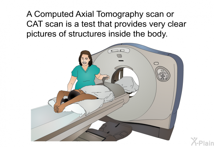 A Computed Axial Tomography scan or CAT scan is a test that provides very clear pictures of structures inside the body.
