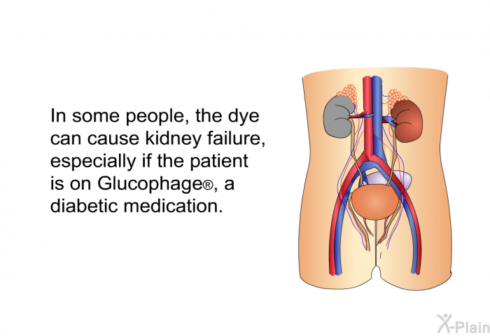 In some people, the dye can cause kidney failure, especially if the patient is on Glucophage , a diabetic medication.