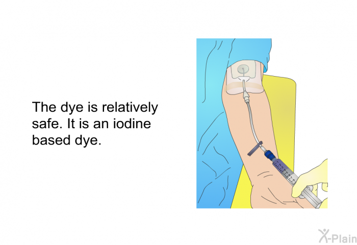 The dye is relatively safe. It is an iodine based dye.