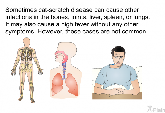 Sometimes cat-scratch disease can cause other infections in the bones, joints, liver, spleen, or lungs. It may also cause a high fever without any other symptoms. However, these cases are not common.