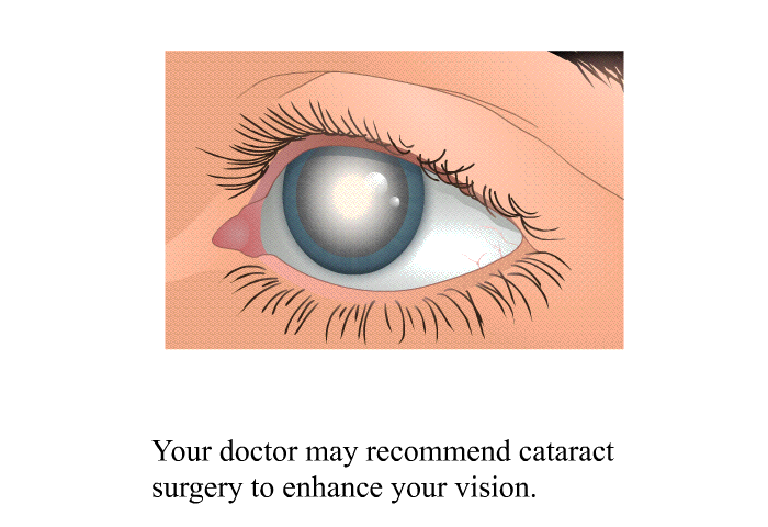 Your doctor may recommend cataract surgery to enhance your vision.