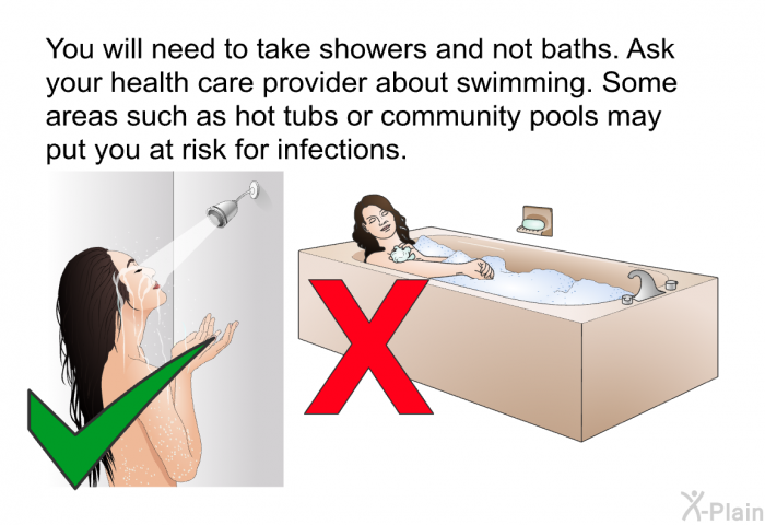 You will need to take showers and not baths. Ask your health care provider about swimming. Some areas such as hot tubs or community pools may put you at risk for infections.