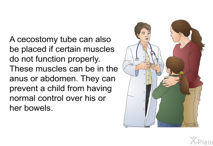 A cecostomy tube can also be placed if certain muscles do not function properly. These muscles can be in the anus or abdomen. They can prevent a child from having normal control over his or her bowels.