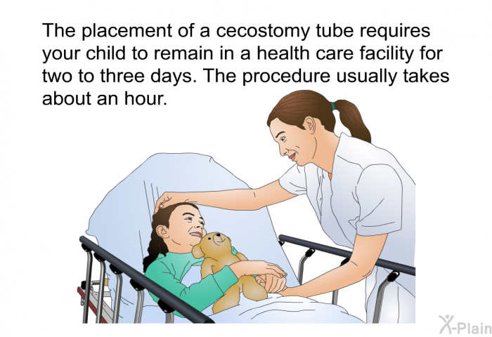 The placement of a cecostomy tube requires your child to remain in a health care facility for two to three days. The procedure usually takes about an hour.