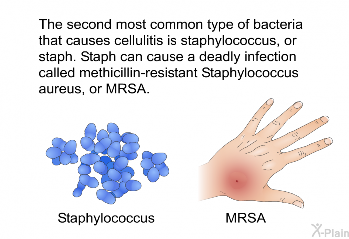 The second most common type of bacteria that causes cellulitis is staphylococcus, or staph. Staph can cause a deadly infection called methicillin-resistant Staphylococcus aureus, or MRSA.