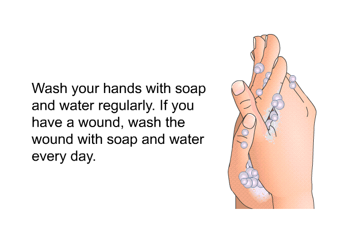 Wash your hands with soap and water regularly. If you have a wound, wash the wound with soap and water every day.