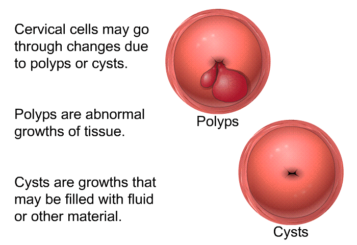 Cervical cells may go through changes due to polyps or cysts. Polyps are abnormal growths of tissue. Cysts are growths that may be filled with fluid or other material.