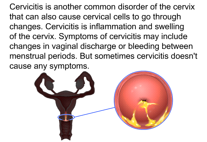Cervicitis is another common disorder of the cervix that can also cause cervical cells to go through changes. Cervicitis is inflammation and swelling of the cervix. Symptoms of cervicitis may include changes in vaginal discharge or bleeding between menstrual periods. But sometimes cervicitis doesn't cause any symptoms.