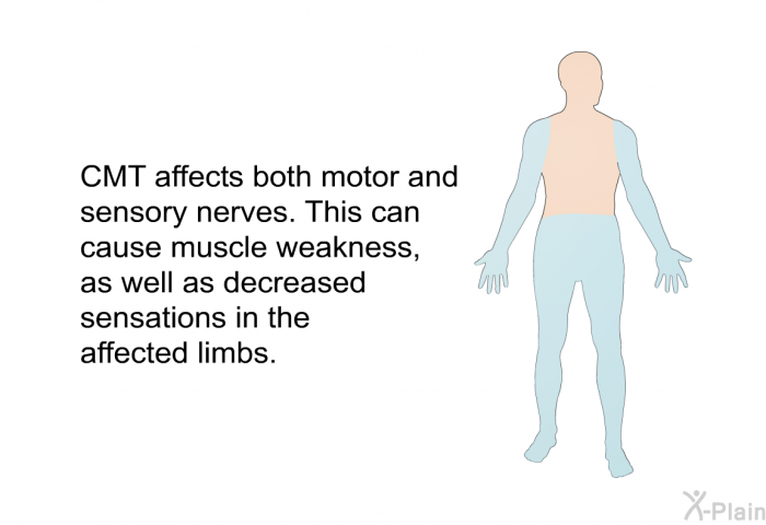CMT affects both motor and sensory nerves. This can cause muscle weakness, as well as decreased sensations in the affected limbs.