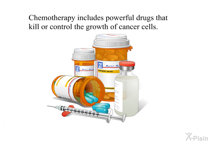 Chemotherapy includes powerful drugs that kill or control the growth of cancer cells.