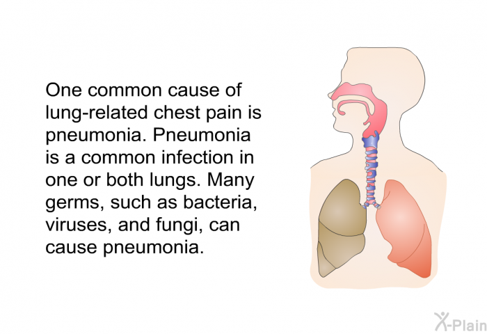 One common cause of lung-related chest pain is pneumonia. Pneumonia is a common infection in one or both lungs. Many germs, such as bacteria, viruses, and fungi, can cause pneumonia.