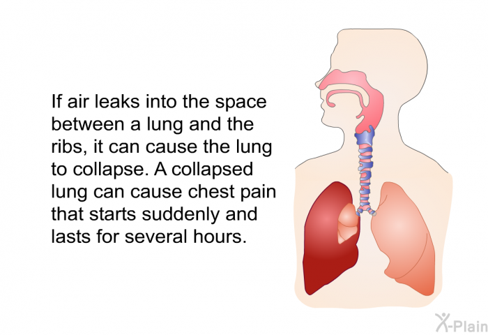 If air leaks into the space between a lung and the ribs, it can cause the lung to collapse. A collapsed lung can cause chest pain that starts suddenly and lasts for several hours.