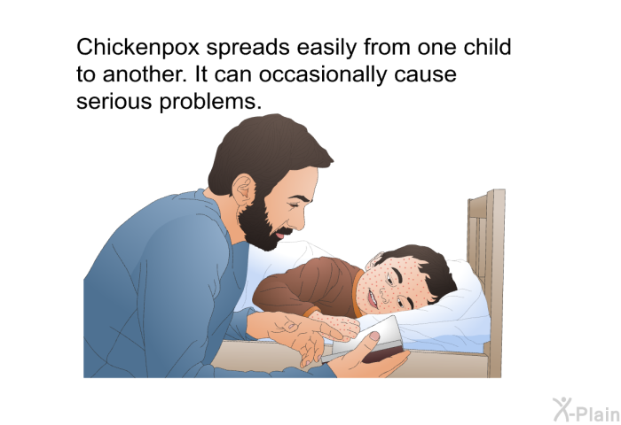 Chickenpox spreads easily from one child to another. It can occasionally cause serious problems.