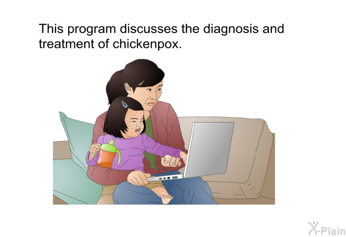 This health information discusses the diagnosis and treatment of chickenpox.