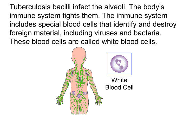 Tuberculosis bacilli infect the alveoli. The body's immune system fights them. The immune system includes special blood cells that identify and destroy foreign material, including viruses and bacteria. These blood cells are called white blood cells.