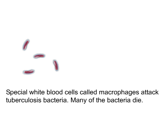 Special white blood cells called macrophages attack tuberculosis bacteria. Many of the bacteria die.