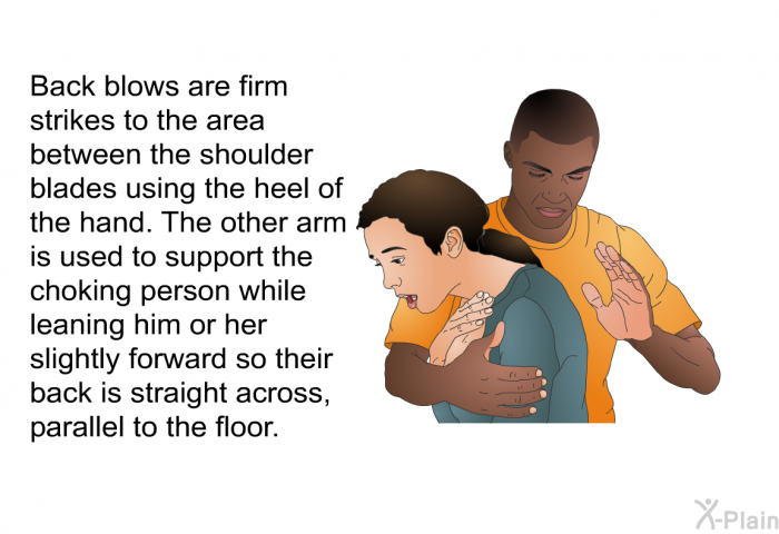 Back blows are firm strikes to the area between the shoulder blades using the heel of the hand. The other arm is used to support the choking person while leaning him or her slightly forward so their back is straight across, parallel to the floor.