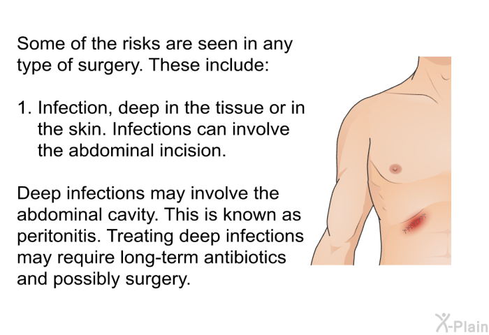 Some of the risks are seen in any type of surgery. These include:  Infection, deep in the tissue or in the skin. Infections can involve the abdominal incision. Deep infections may involve the abdominal cavity. This is known as peritonitis. Treating deep infections may require long-term antibiotics and possibly surgery.