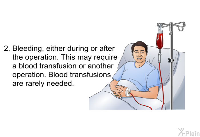Bleeding, either during or after the operation. This may require a blood transfusion or another operation. Blood transfusions are rarely needed.