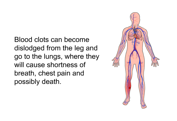 Blood clots can become dislodged from the leg and go to the lungs, where they will cause shortness of breath, chest pain and possibly death.