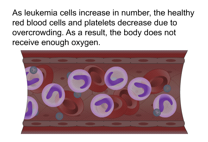 As leukemia cells increase in number, the healthy red blood cells and platelets decrease due to overcrowding. As a result, the body does not receive enough oxygen.
