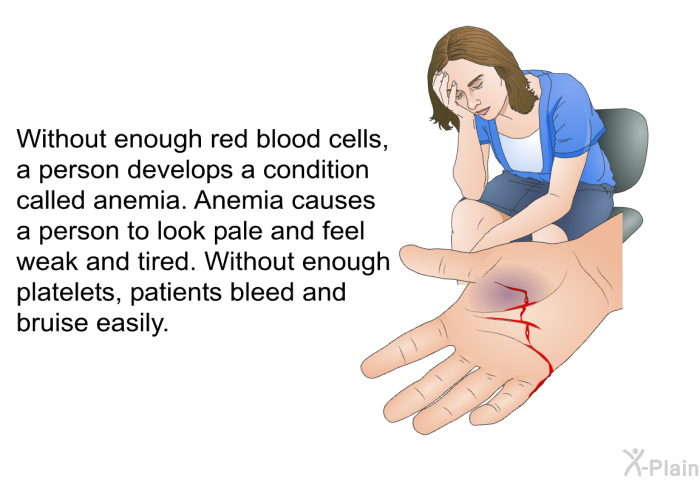 Without enough red blood cells, a person develops a condition called anemia. Anemia causes a person to look pale and feel weak and tired. Without enough platelets, patients bleed and bruise easily.