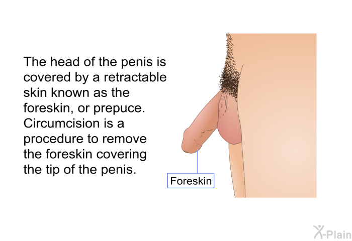 The head of the penis is covered by a retractable skin known as the foreskin, or prepuce. Circumcision is a procedure to remove the foreskin covering the tip of the penis.