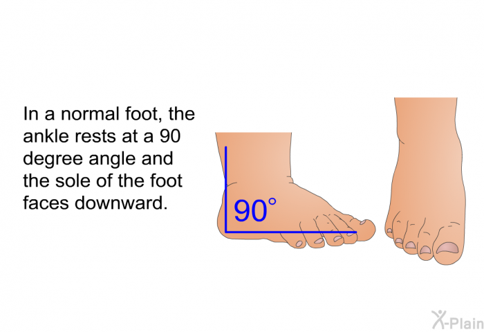 In a normal foot, the ankle rests at a 90 degree angle and the sole of the foot faces downward.