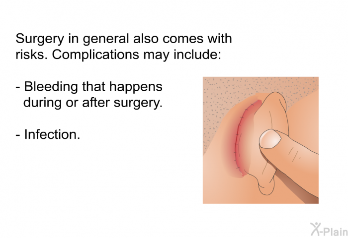 Surgery in general also comes with risks. Complications may include:  Bleeding that happens during or after surgery. Infection.