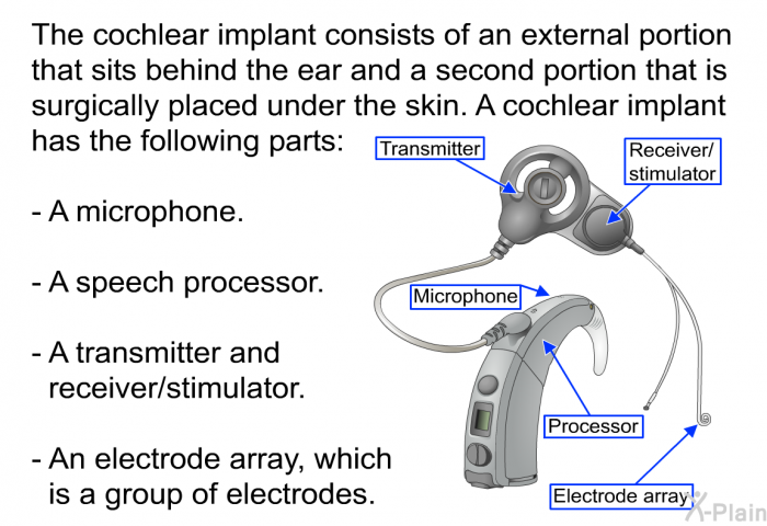 The cochlear implant consists of an external portion that sits behind the ear and a second portion that is surgically placed under the skin. A cochlear implant has the following parts:  A microphone. A speech processor. A transmitter and receiver/stimulator. An electrode array, which is a group of electrodes.
