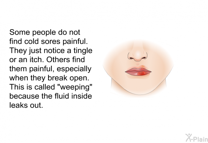 Some people do not find cold sores painful. They just notice a tingle or an itch. Others find them painful, especially when they break open. This is called “weeping” because the fluid inside leaks out.