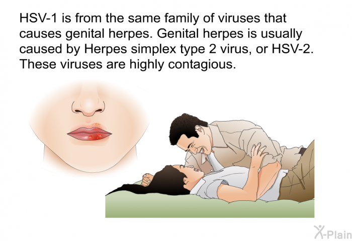 HSV-1 is from the same family of viruses that causes genital herpes. Genital herpes is usually caused by Herpes simplex type 2 virus, or HSV-2. These viruses are highly contagious.