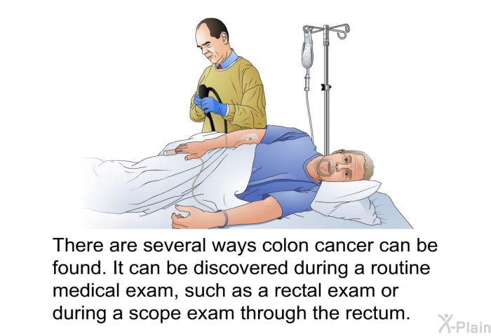 There are several ways colon cancer can be found. It can be discovered during a routine medical exam, such as a rectal exam or during a scope exam through the rectum.