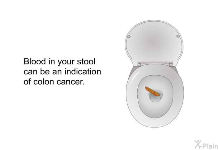 Blood in your stool can be an indication of colon cancer.