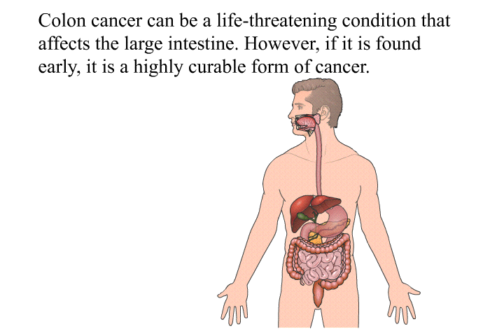 Colon cancer can be a life-threatening condition that affects the large intestine. However, if it is found early, it is a highly curable form of cancer.