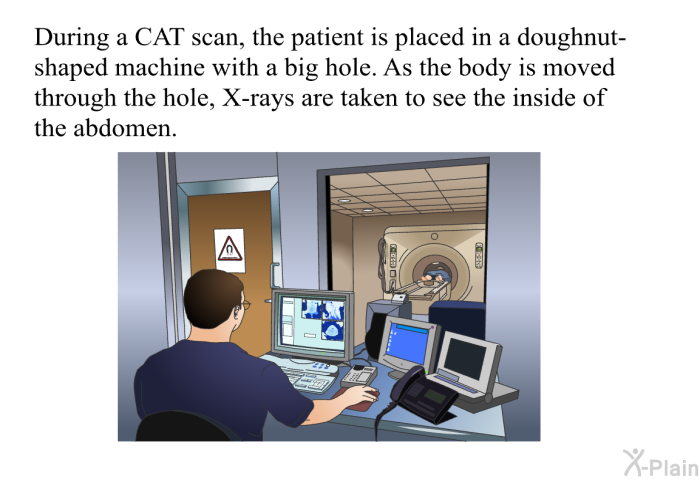 During a CAT scan, the patient is placed in a doughnut-shaped machine with a big hole. As the body is moved through the hole, X-rays are taken to see the inside of the abdomen.